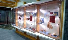 Collections Archéologiques de Girmou